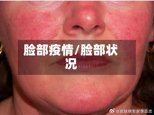 脸部疫情/脸部状况-第2张图片