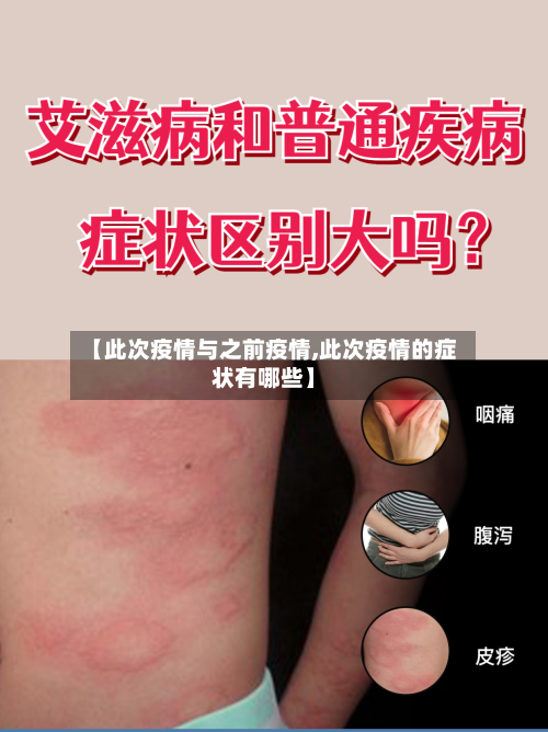 【此次疫情与之前疫情,此次疫情的症状有哪些】