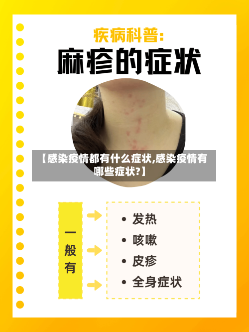 【感染疫情都有什么症状,感染疫情有哪些症状?】-第2张图片