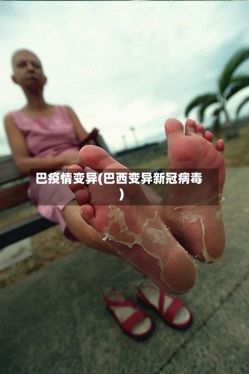 巴疫情变异(巴西变异新冠病毒)