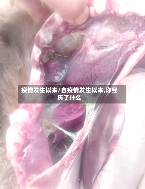 疫情发生以来/自疫情发生以来,你经历了什么