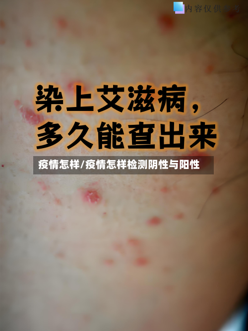 疫情怎样/疫情怎样检测阴性与阳性-第2张图片