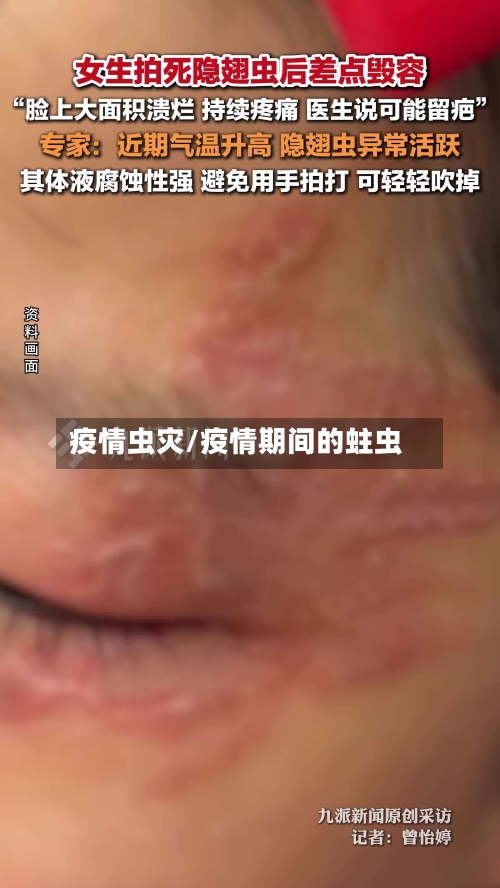 疫情虫灾/疫情期间的蛀虫-第2张图片