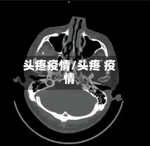 头疼疫情/头疼 疫情-第2张图片