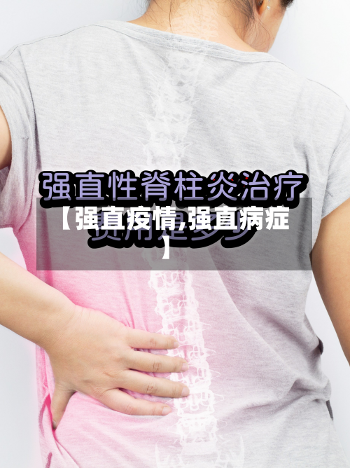 【强直疫情,强直病症】-第2张图片