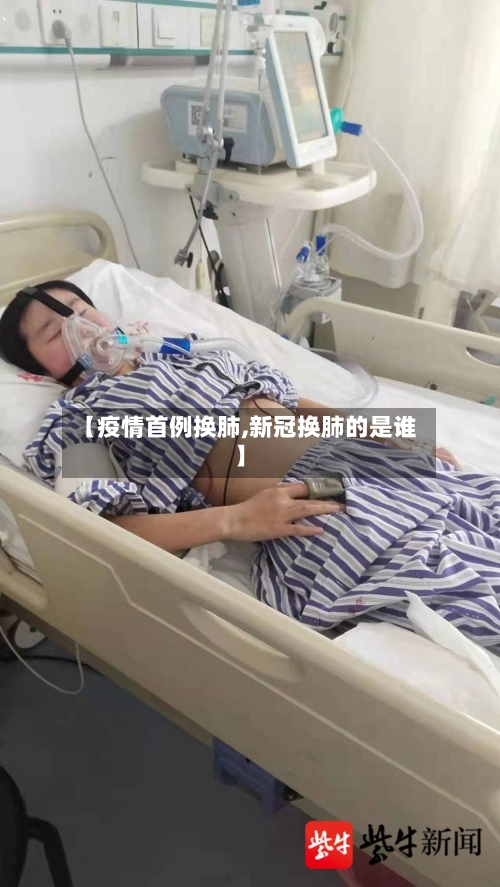 【疫情首例换肺,新冠换肺的是谁】-第3张图片